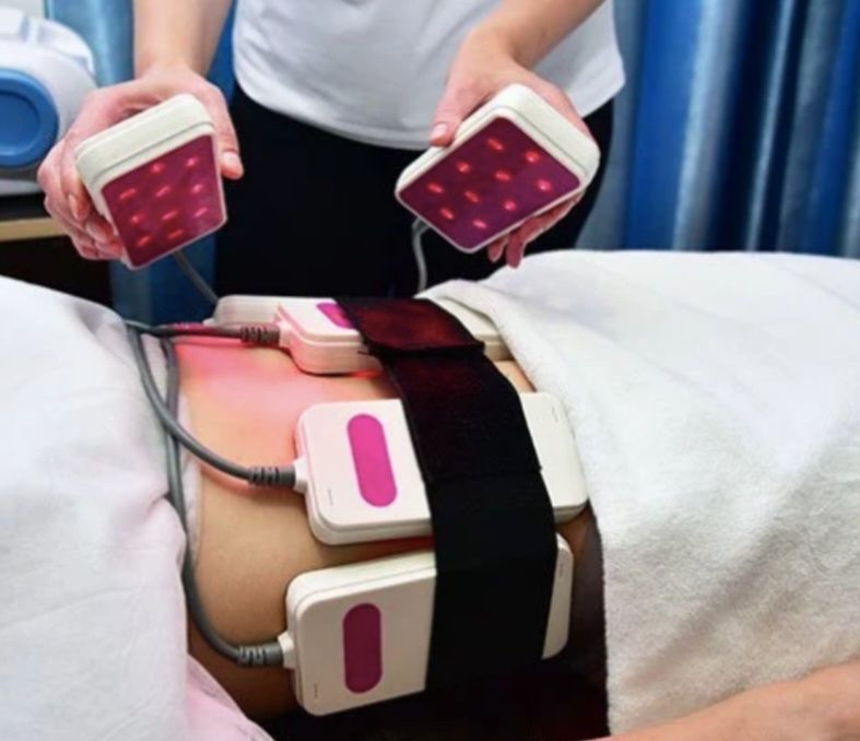 Laser Lipo