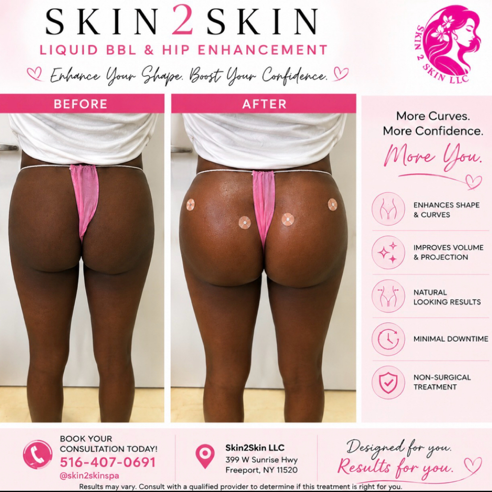 Skin2Skin Liquid BBL VIP Training at Skin2skin LLC in Freeport, NY