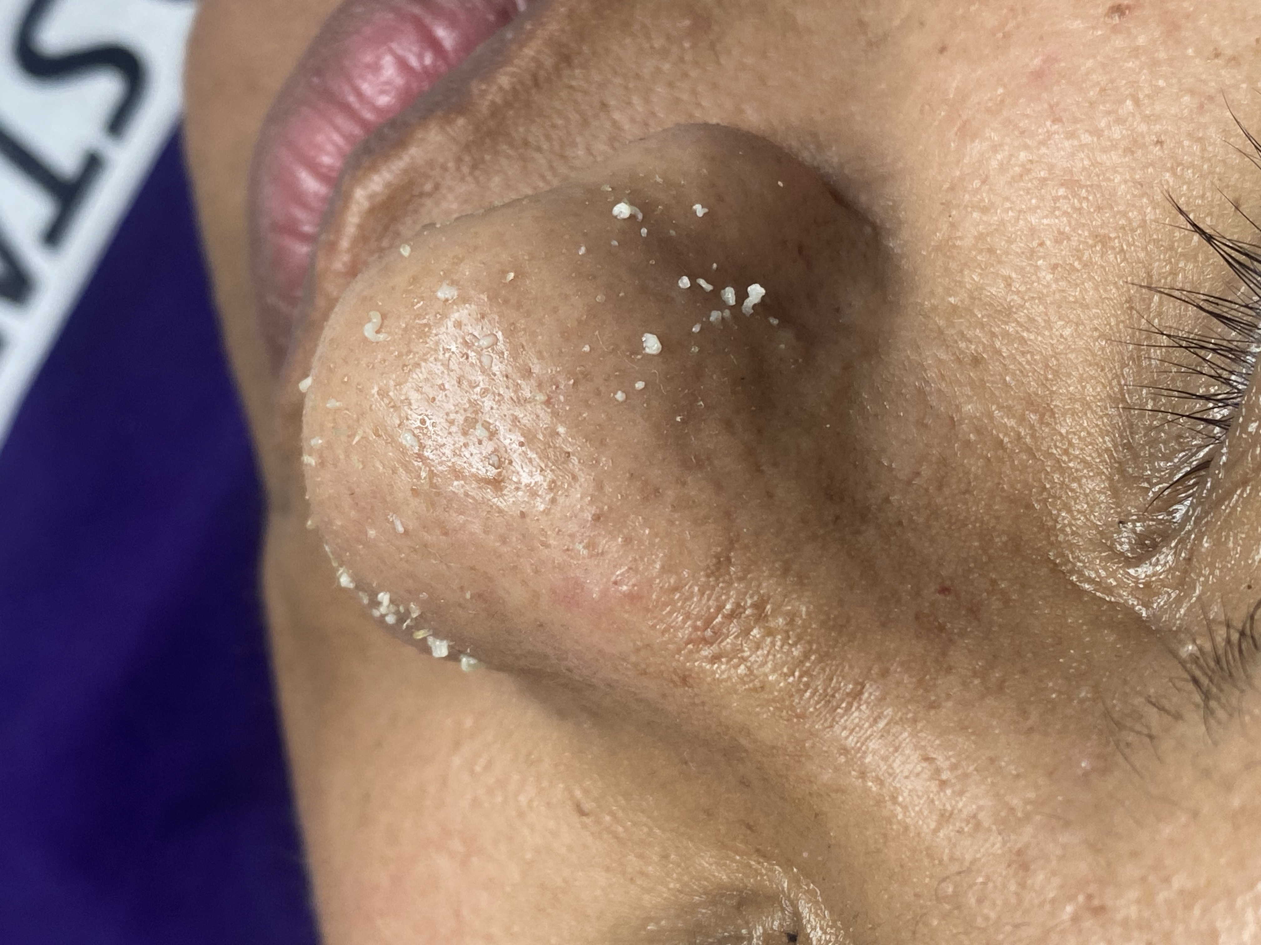 Deep Cleansing facial