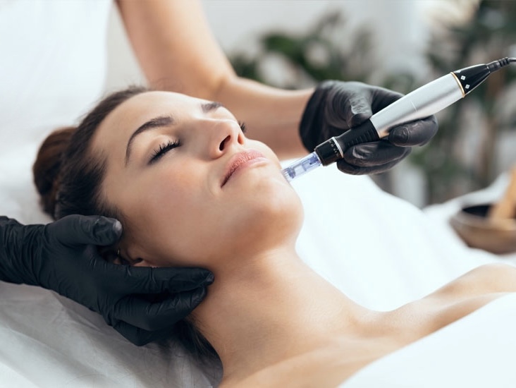 Micro Needling Facial