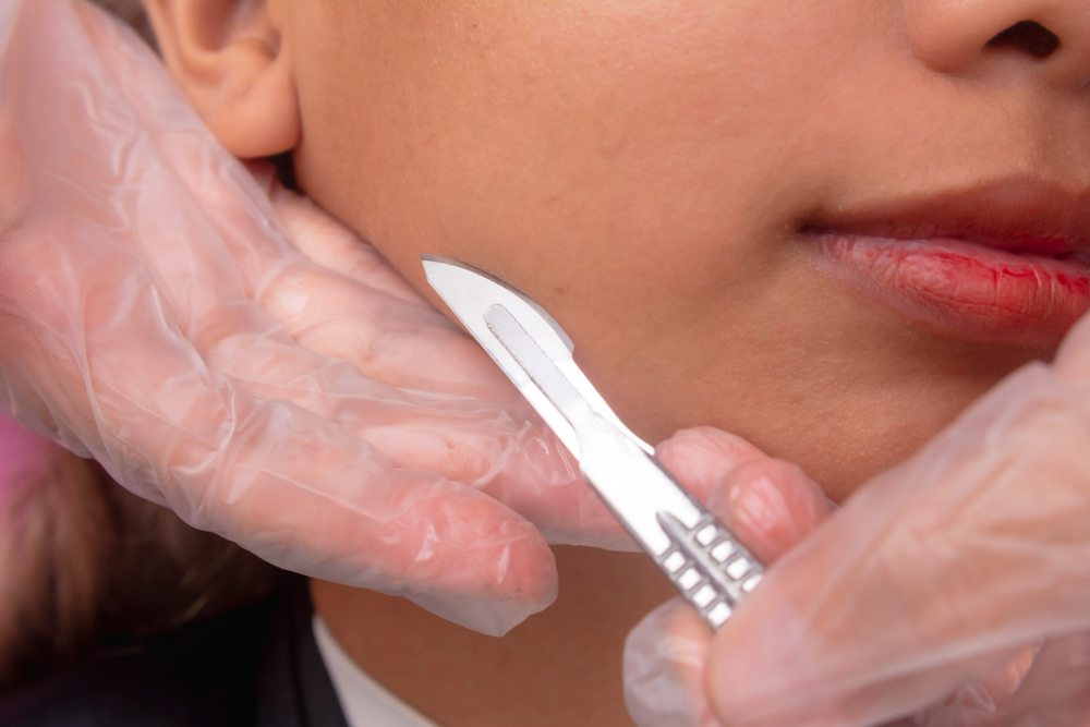 Dermaplane Express Facial at Aesthetic Society in Middleton, WI
