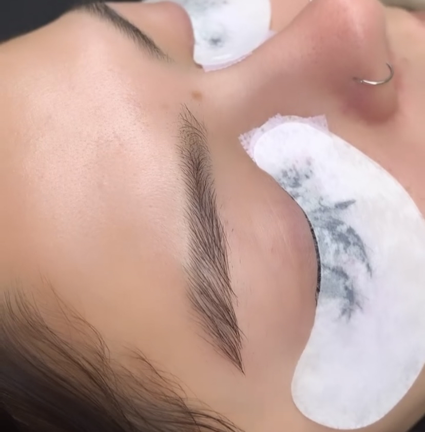Eyelash Removal