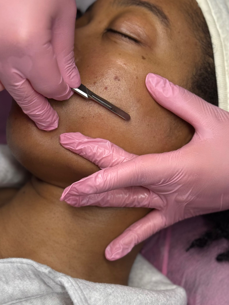 Dermaplaning Facial