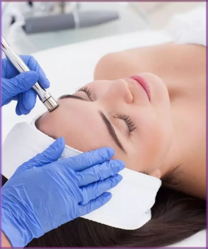 Diamond Microdermabrasion