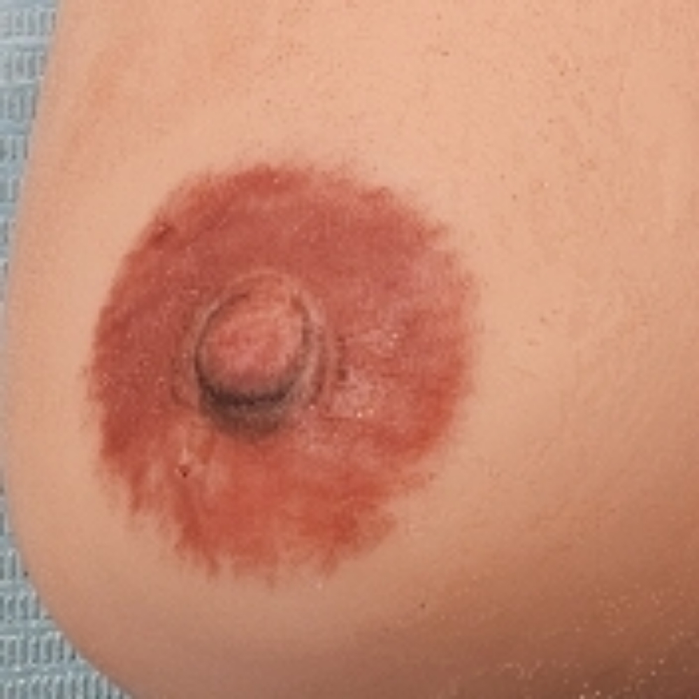 Areola/Nipple Repigmentation at Aligned Beauty & Wellness in Davenport, IA