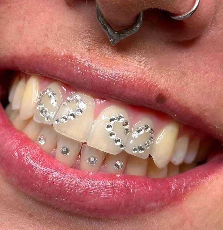 5 Tooth Gems