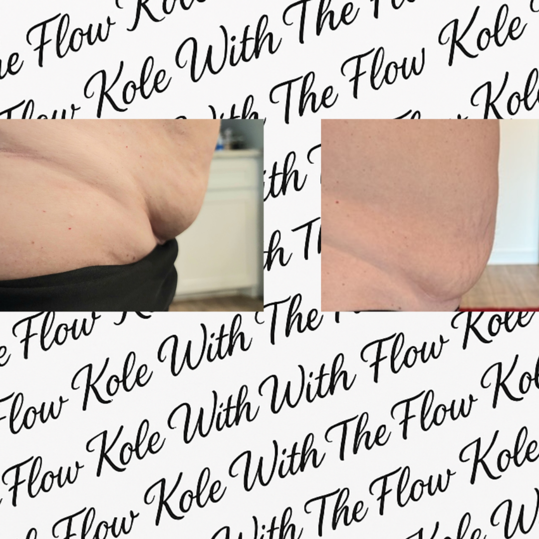 Liquid Lipo Luxe at Kole With The Flow in Corpus Christi, TX