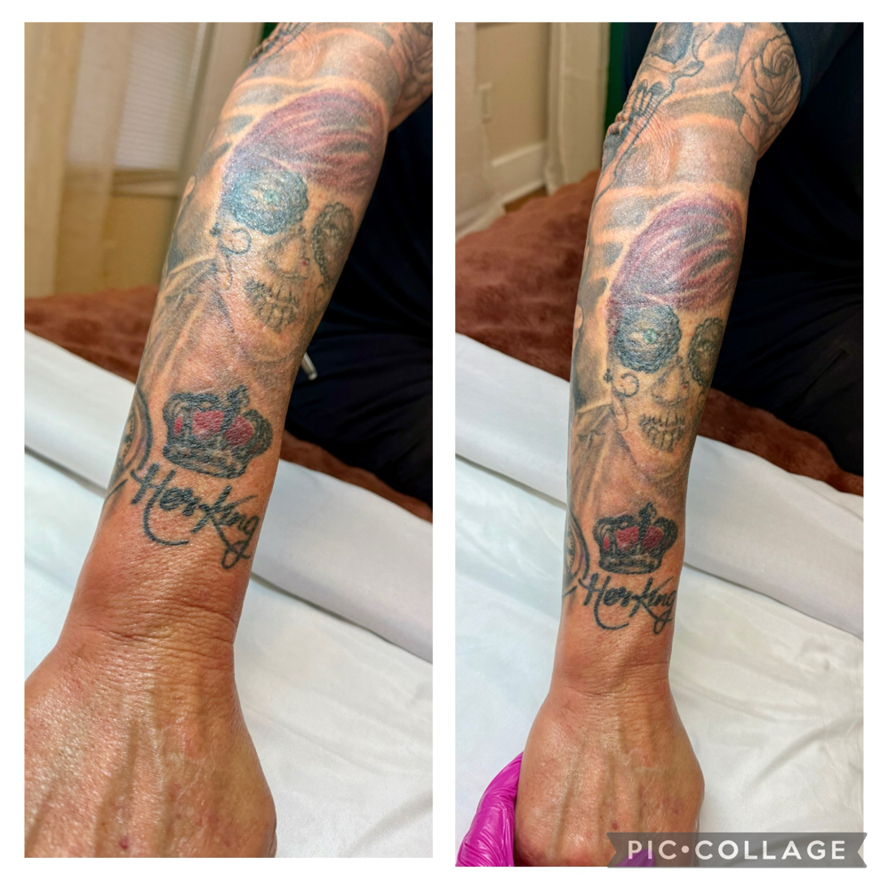 Arm Wax at Ali Lanelle Esthetics in summerville, SC