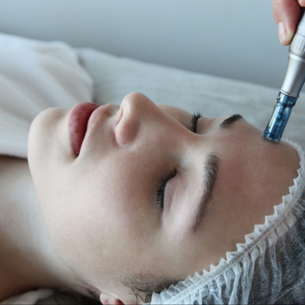 Microneedling at Be Youtiful Aesthetic in Orlando, FL
