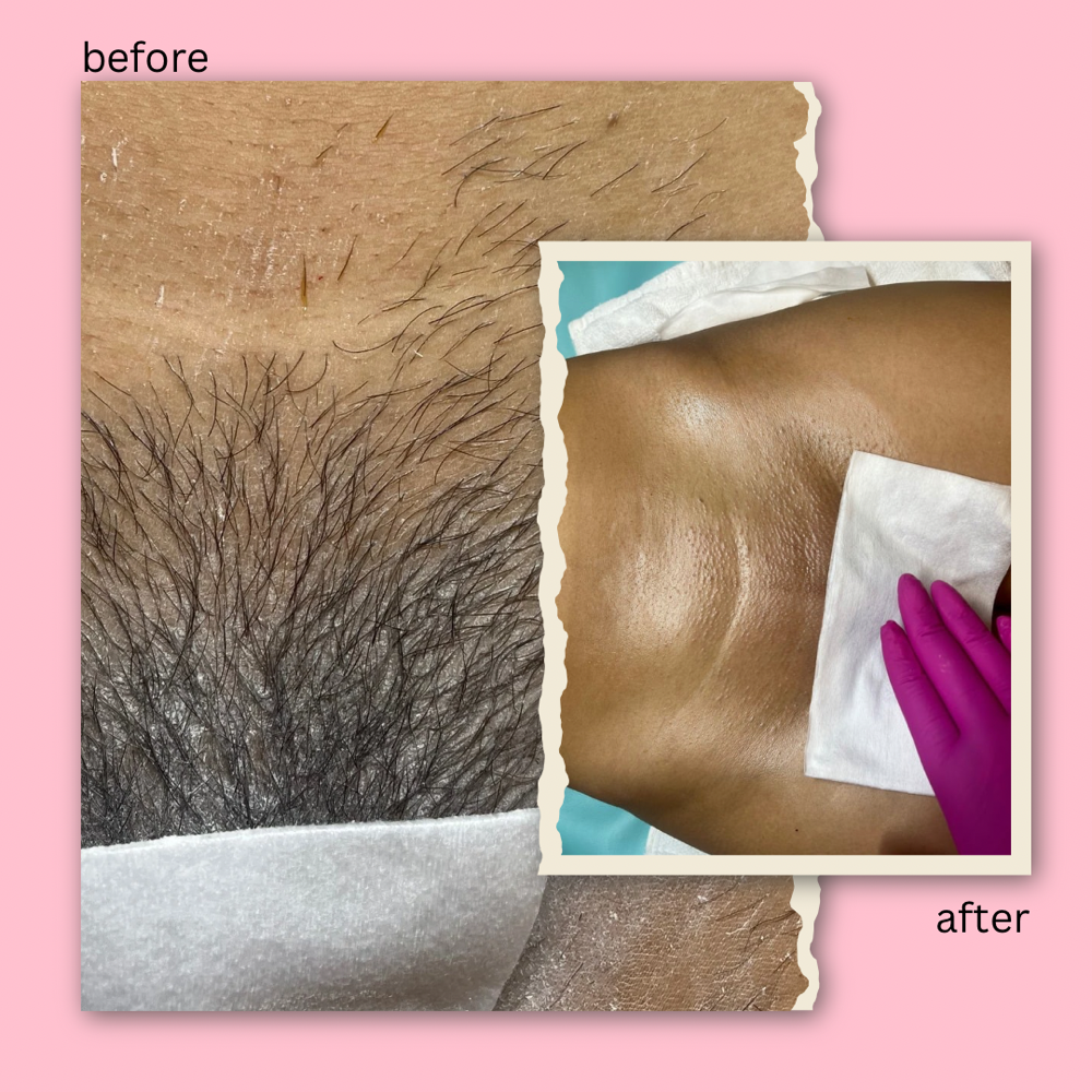 Brazillian sugar (full)