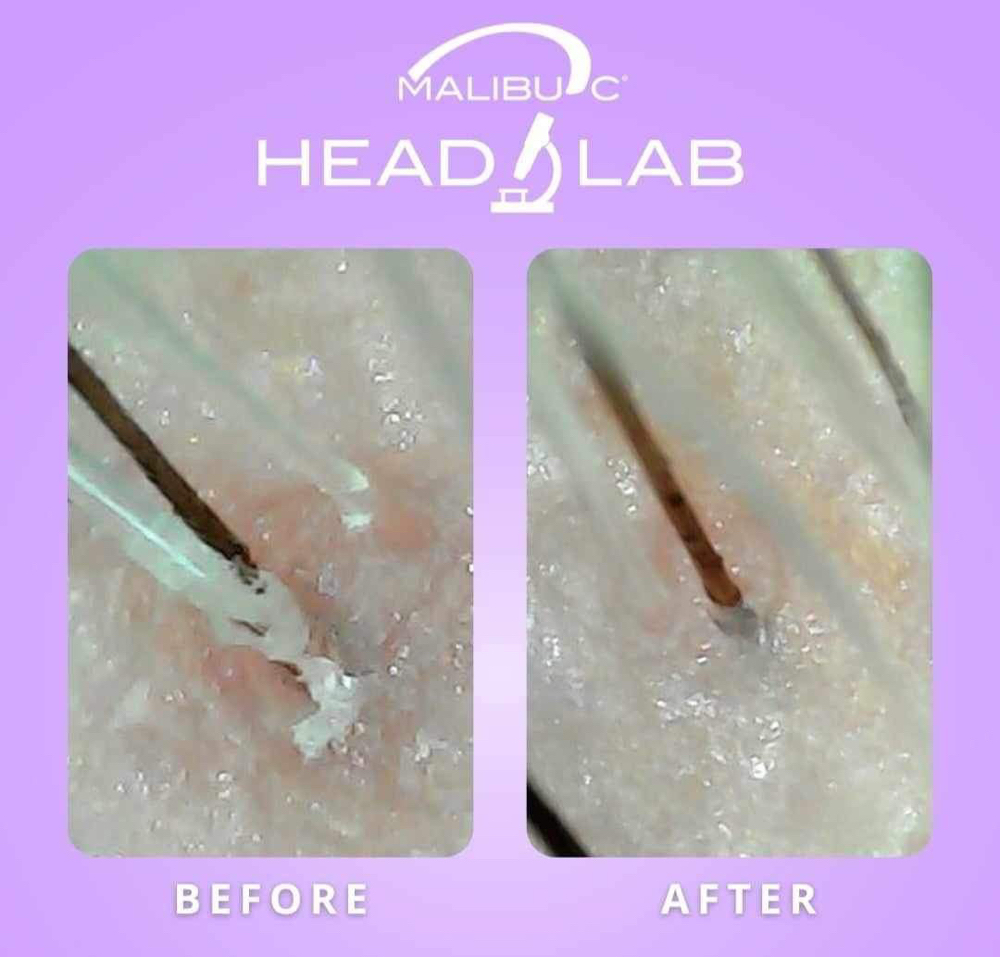 Deluxe Scalp Treatment