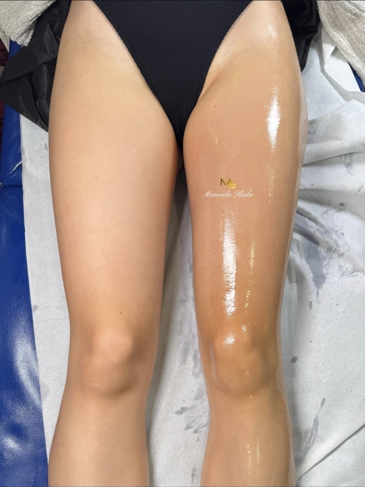 Lymphomodeling Legs Only