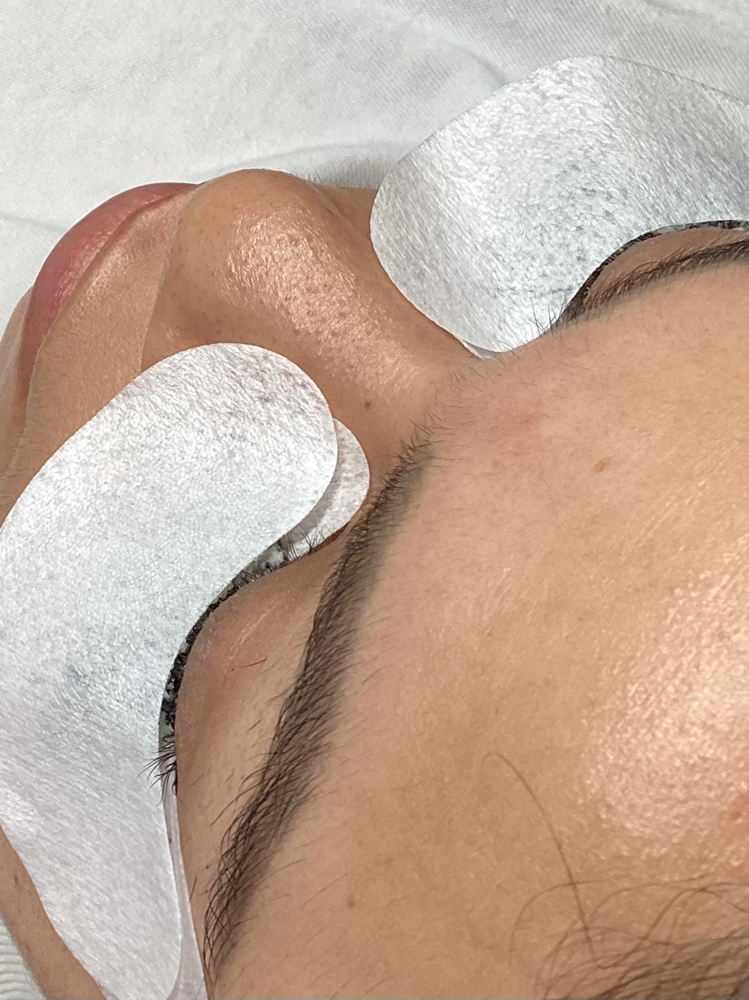 Lash Removal