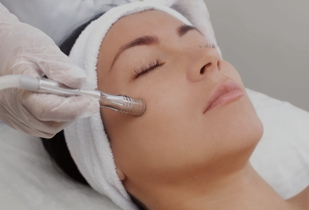 Microdermabrasion Facial