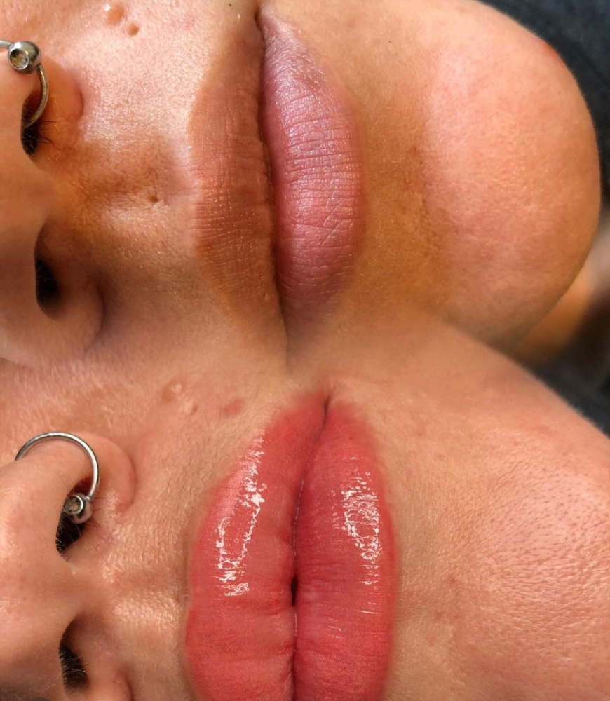 Lip Blushing Treatment 2