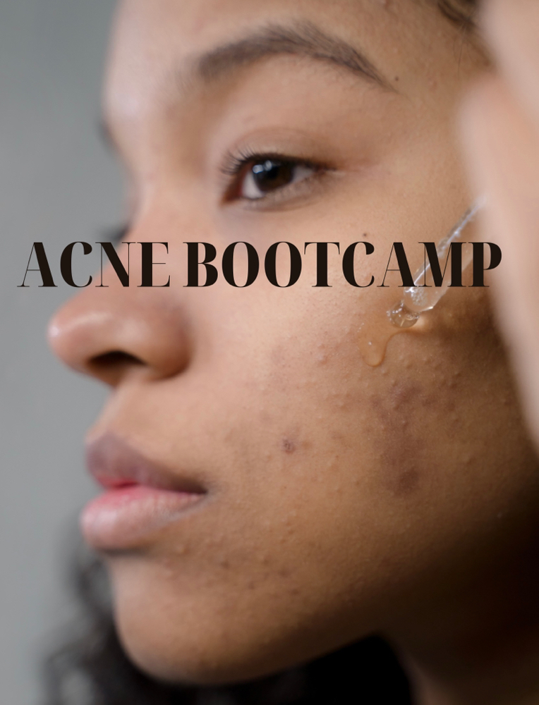 Acne Bootcamp Package