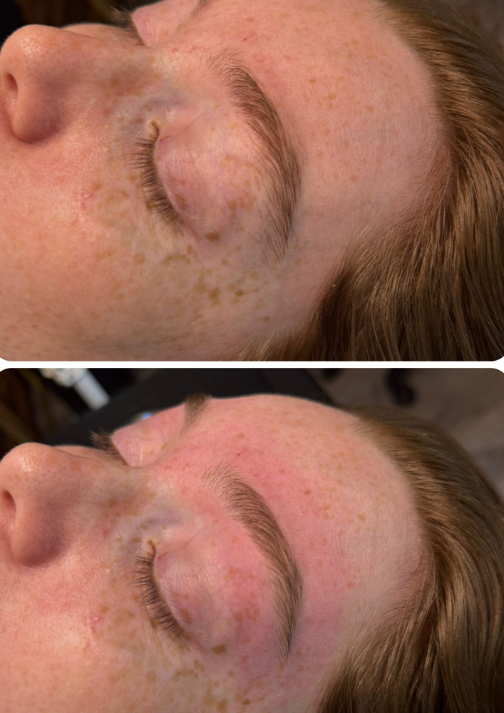Eyebrow Wax