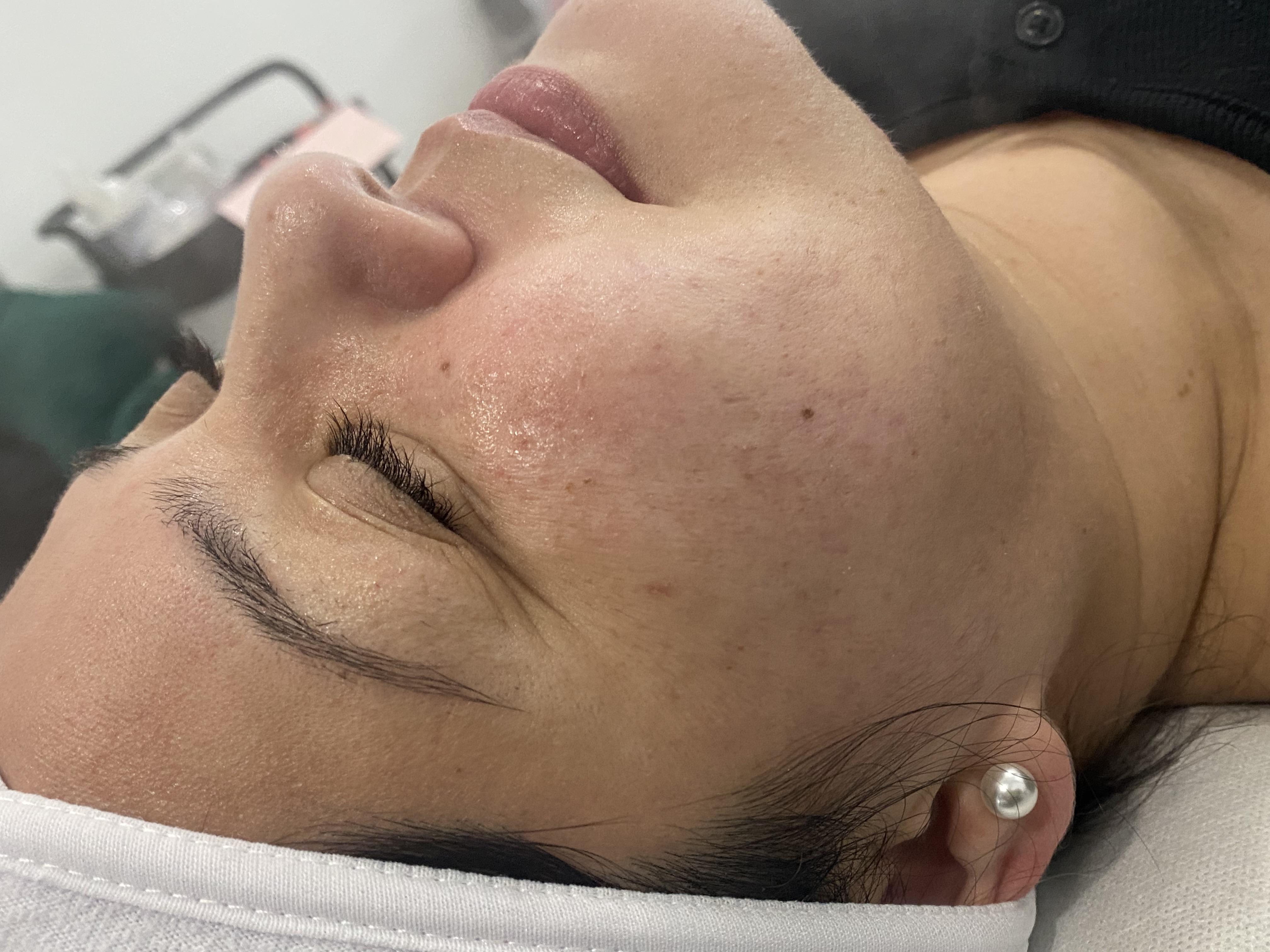 EXPRESS Facial