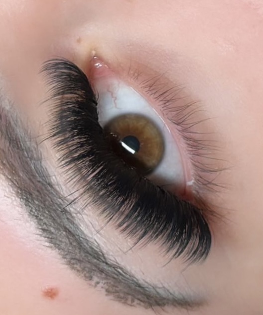 Mega Volume Set Fill