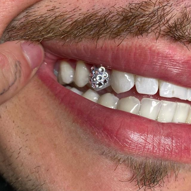 4 STUDDED TOOTH GEMS