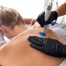 Hydrafacial Back Treatment