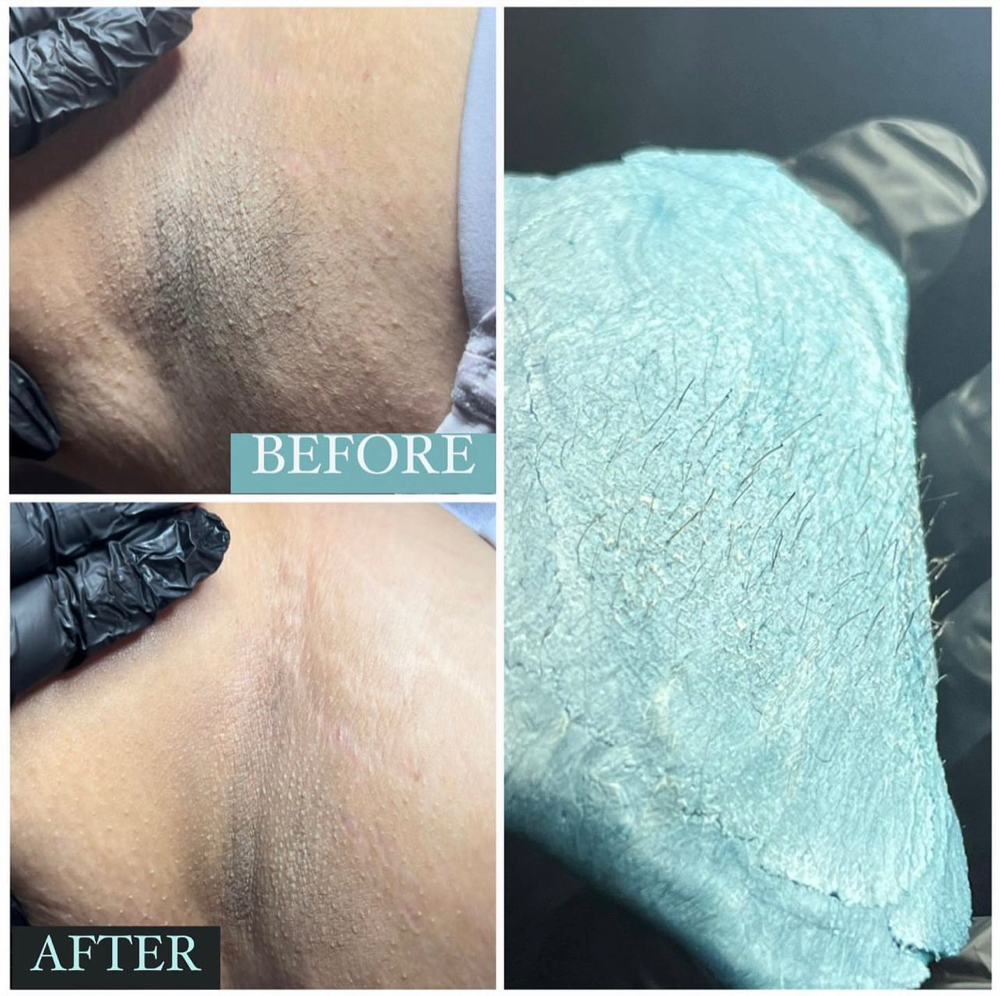 Underarm Wax