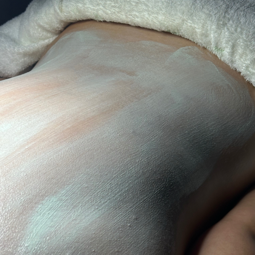 SGG Back Facial at Summer Glo and Glam Esthetics in Crown Point, IN