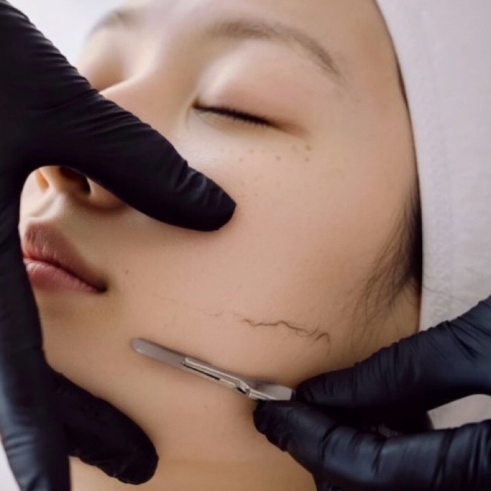 60 Min Luxury Dermaplaning facial at My Favorite Spa in North Carolina, NC