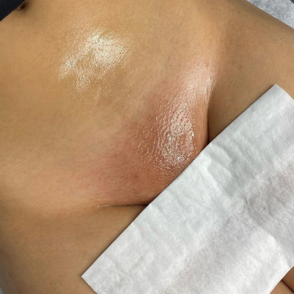 Brazillian & Underarm Combo at Beauty & Bodywork by:Abbyssinia in St Thomas, VI
