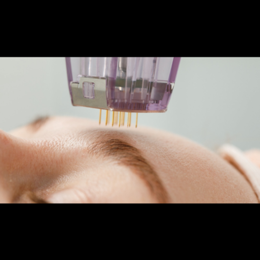 Taylor’d Micro-Channeling Facial™ at Taylor Made It LLC in Independence, MO