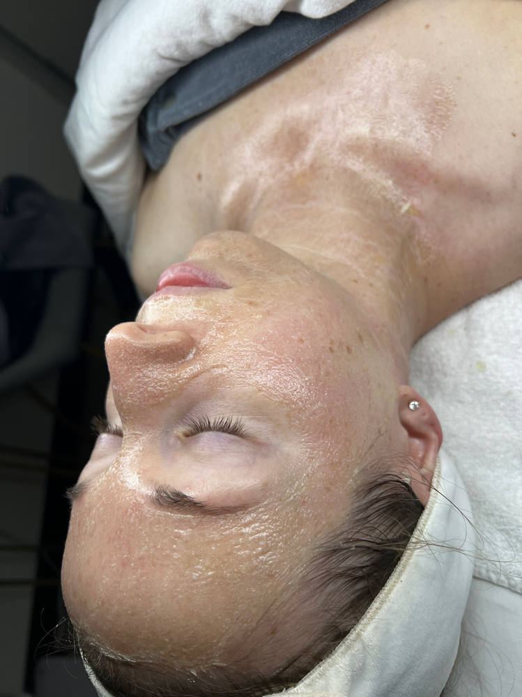 Firming Peptide Treatment