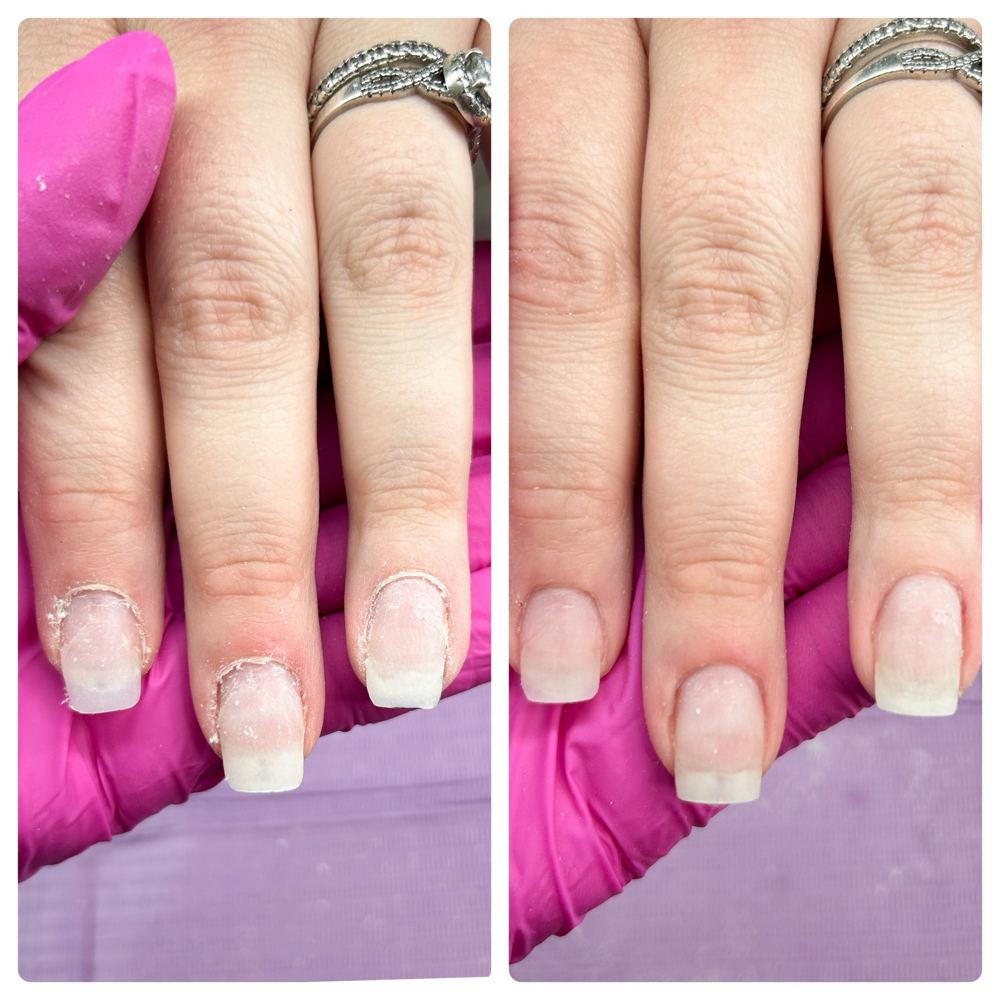 Cuticle Treatment