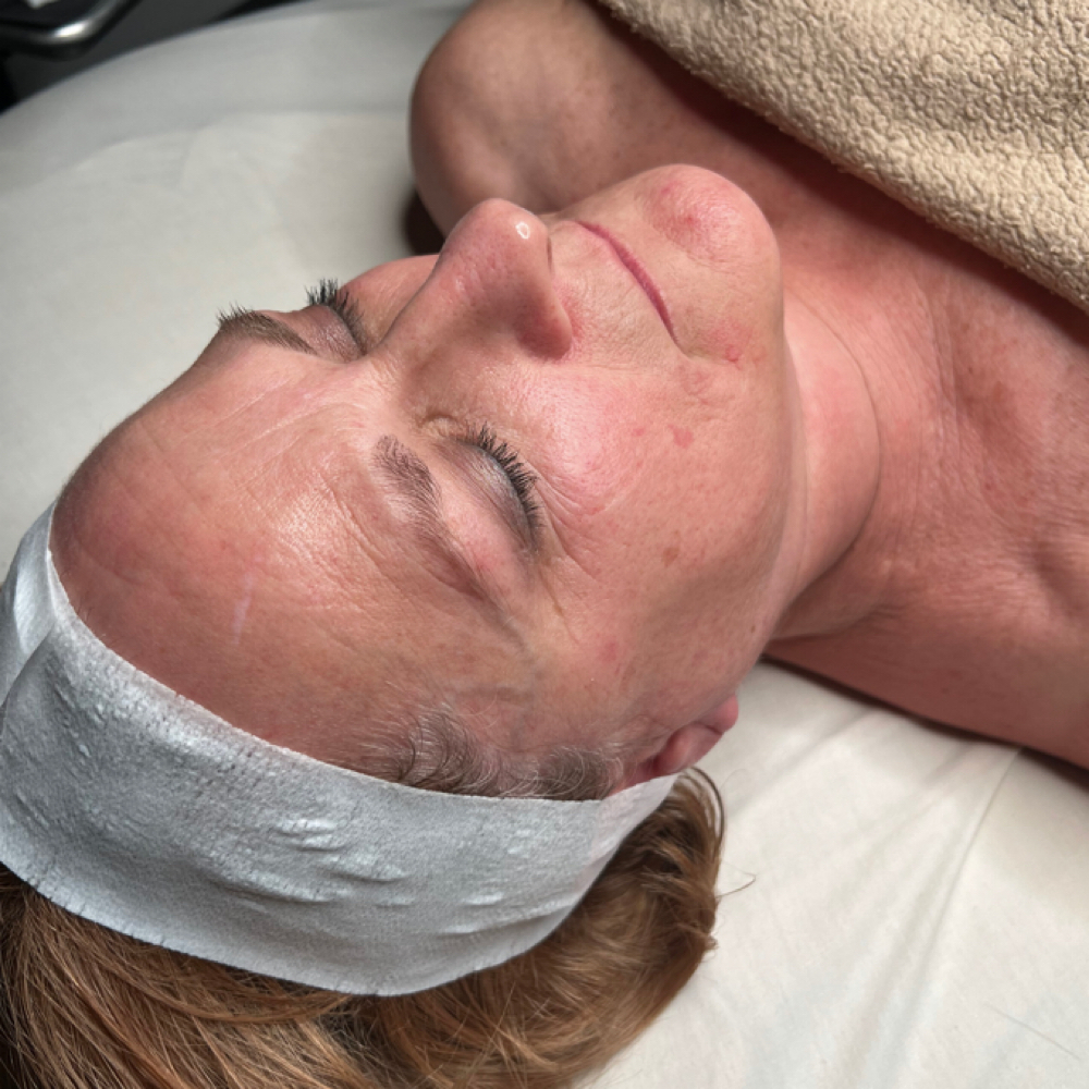 Speciality Facials at VICI Beauty and Spa in Boardman, OH