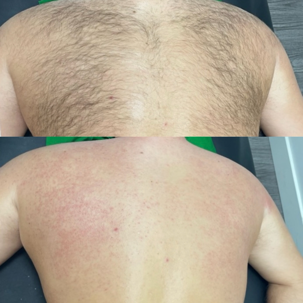 Back Full