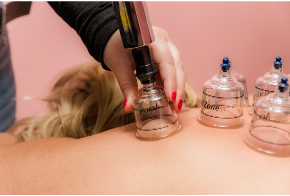 Cupping Massage