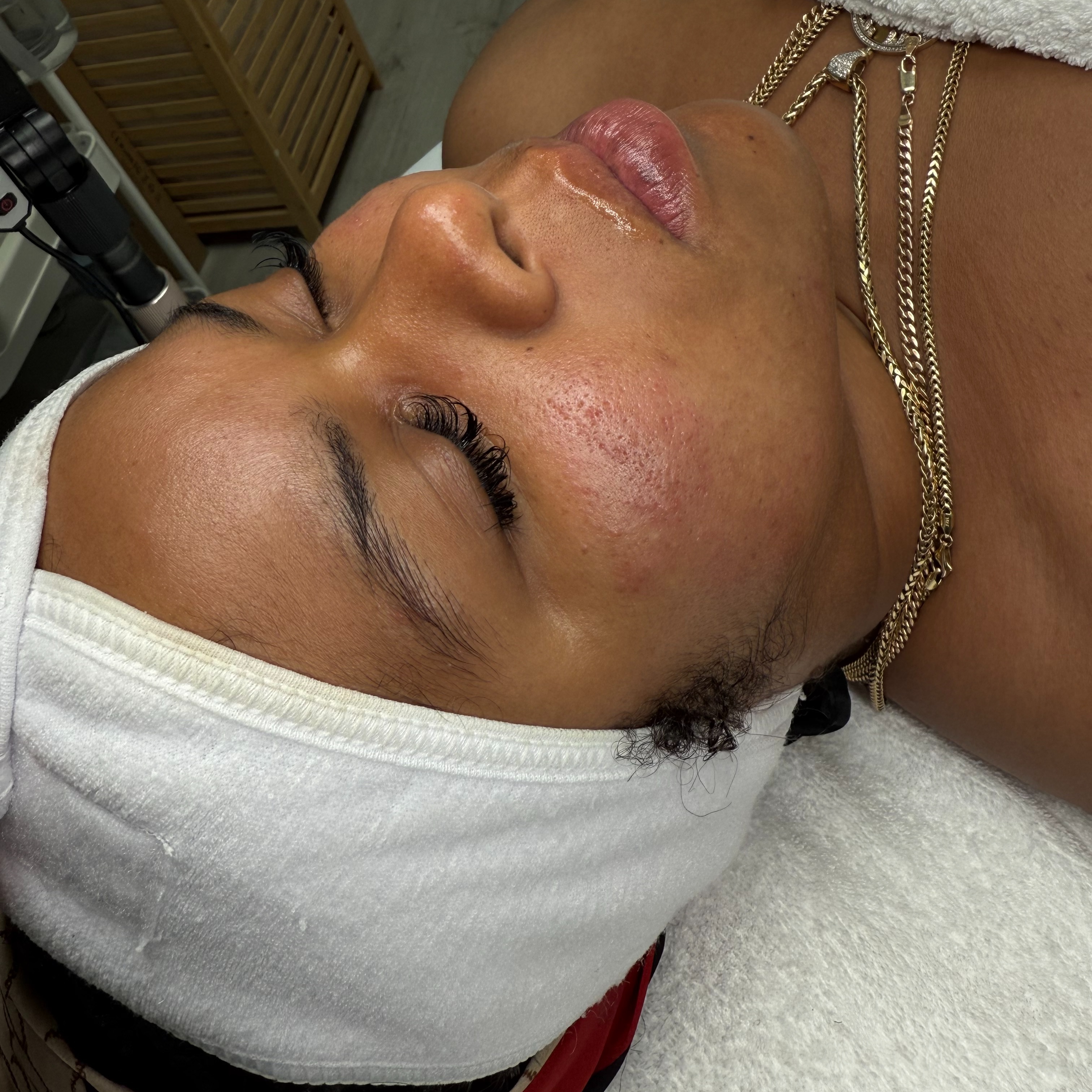 Pore Perfection Facial at Velnaira in Lakewood, CA