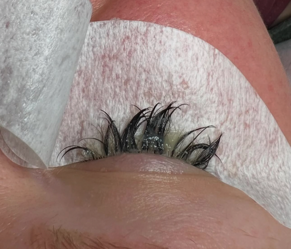 Lash Removal