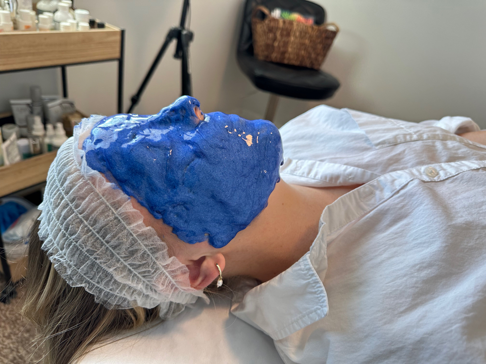 Chemical Peel
