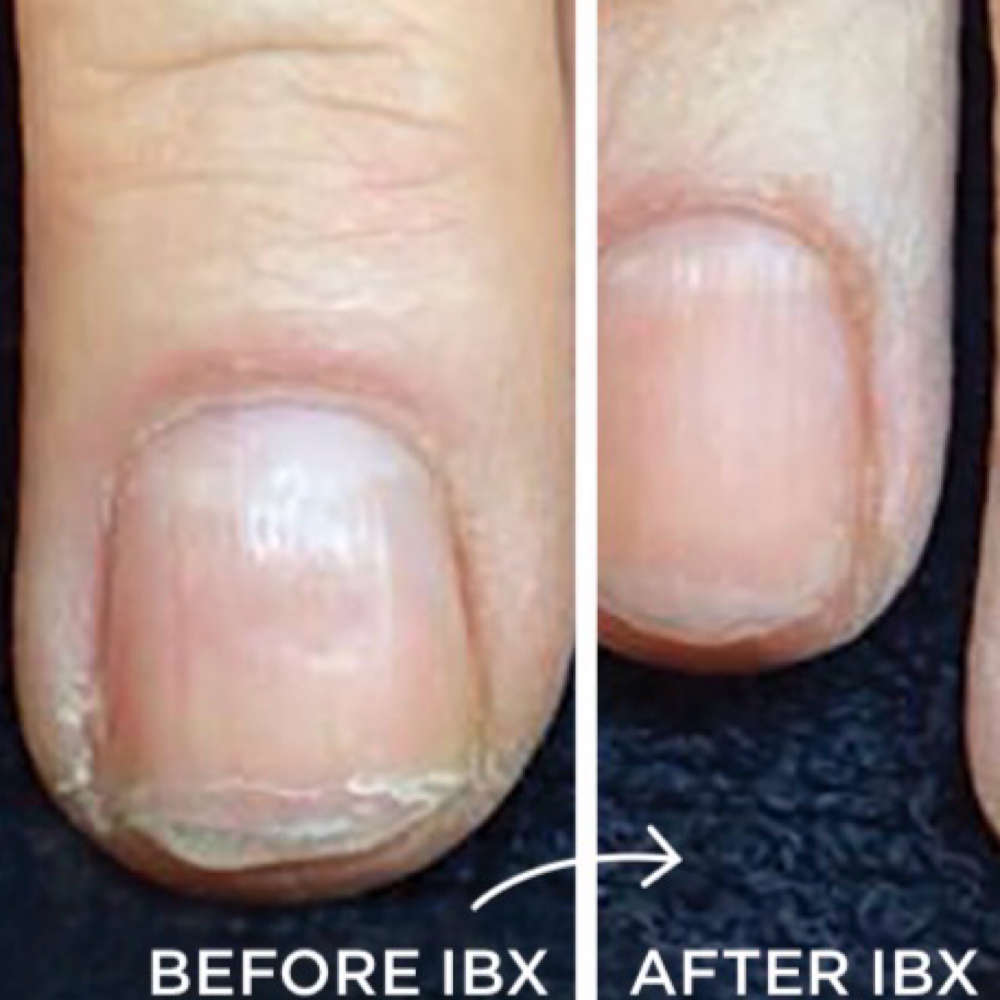 IBX Nail System at The Nail District in Reisterstown, MD