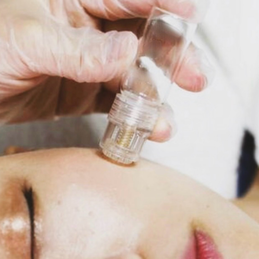 PDRN Glass Skin Microinfusion F at Aquariusfacialspa in Matthews, NC