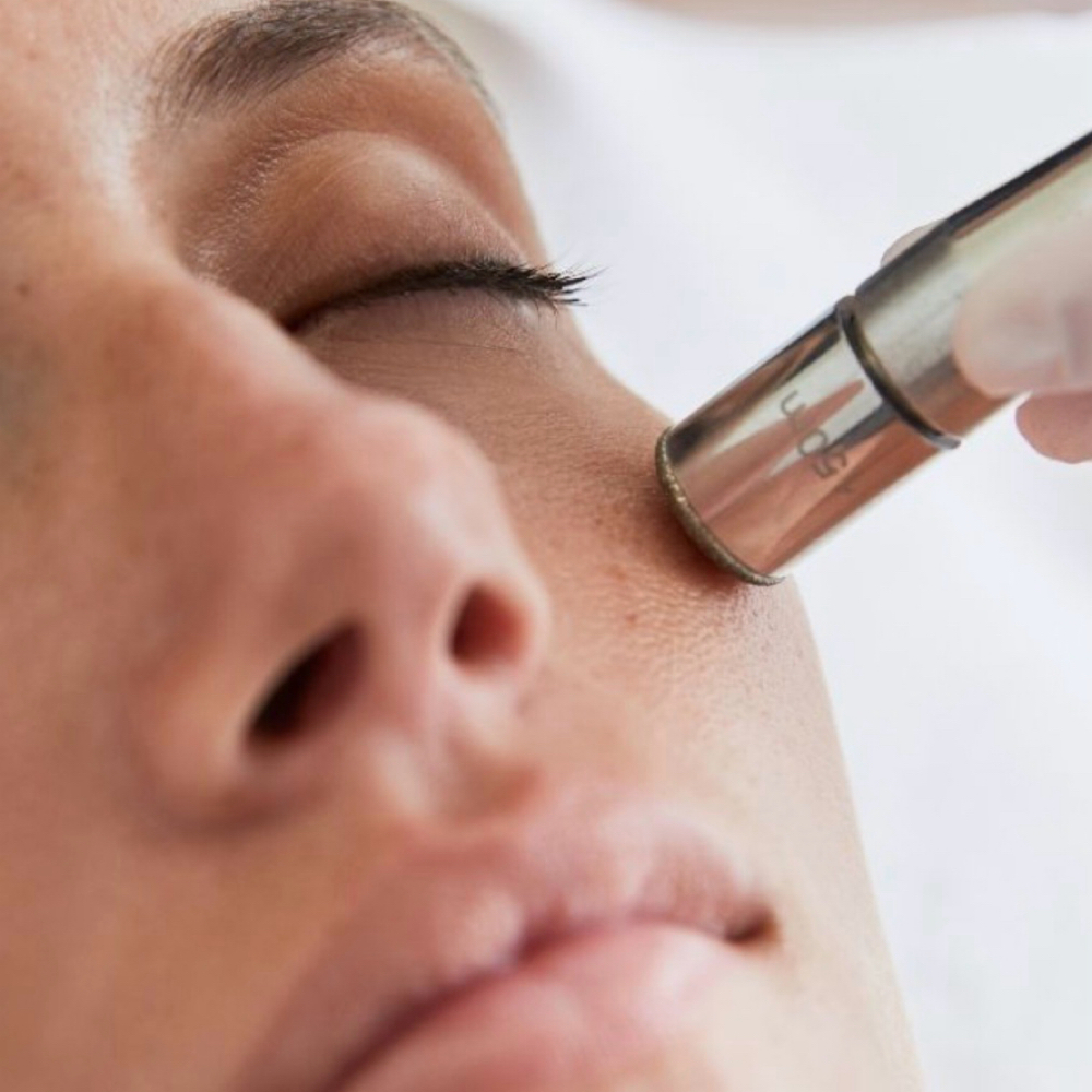 refresh microderm at re:set in Dallas, TX