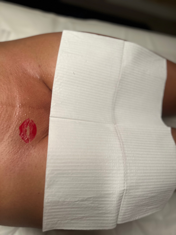 Bare Brazilian at Retreat Skin Spa in Fort Lauderdale, FL