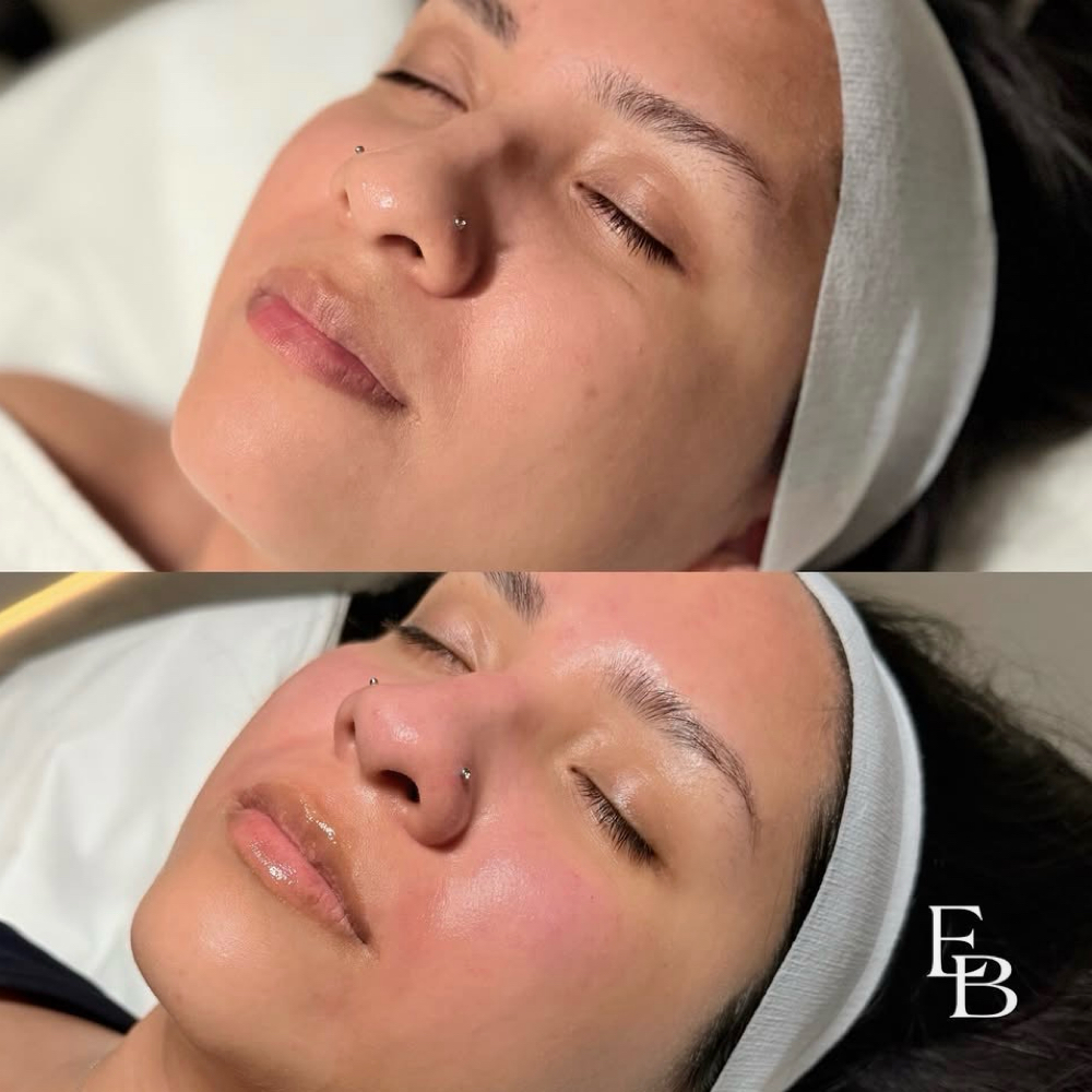 Custom Intro Facial at Eres Bella Day Spa in Bell, CA