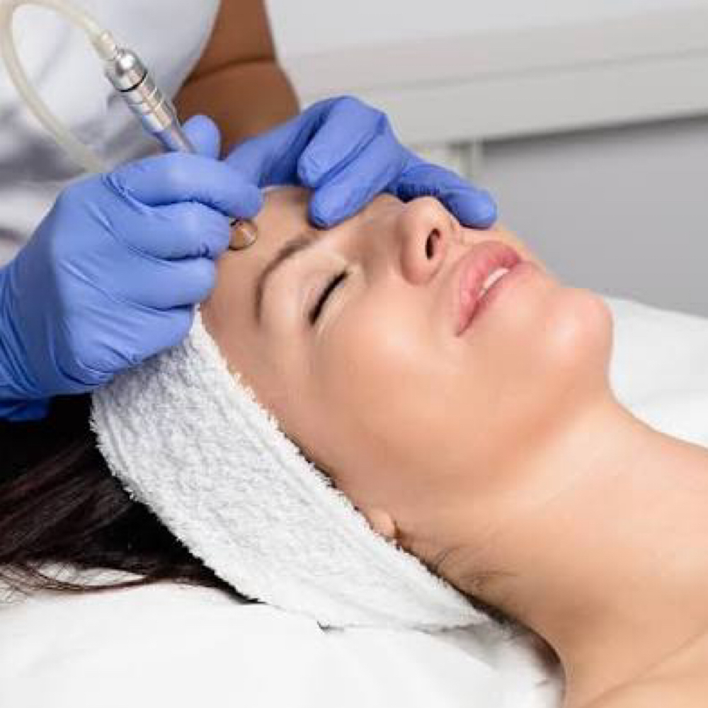 Microdermabarsion Facial at All Aesthetics Kare in Upland, CA