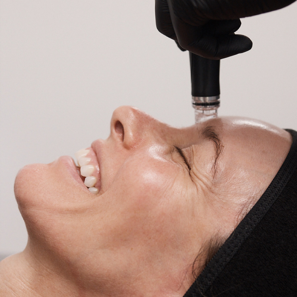 HYDRAFACIAL Platinum at Skin Science Studio in Miami Beach, FL
