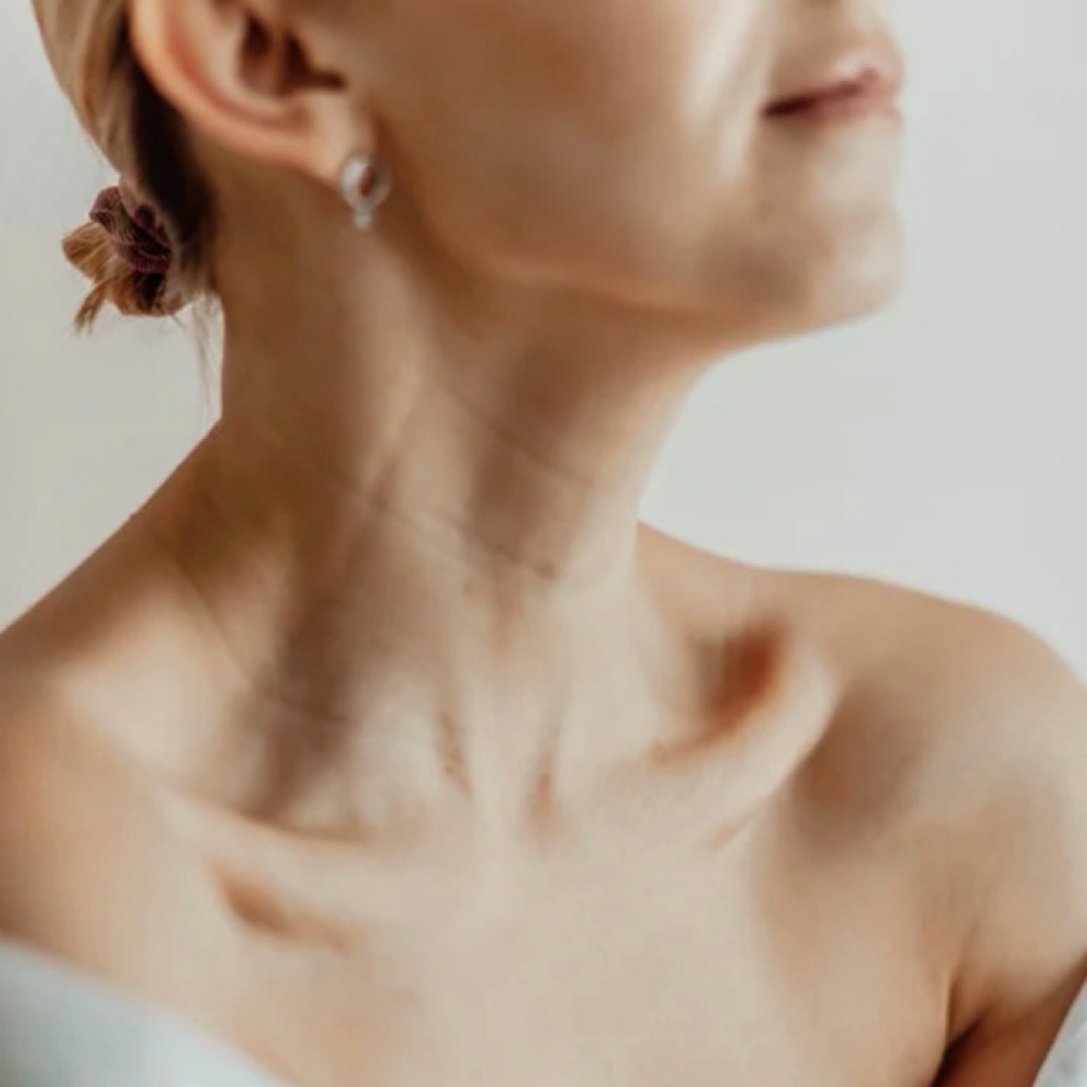 Nefertiti Neck Lift at Optimist Aesthetics LLC in Kingsville, TX