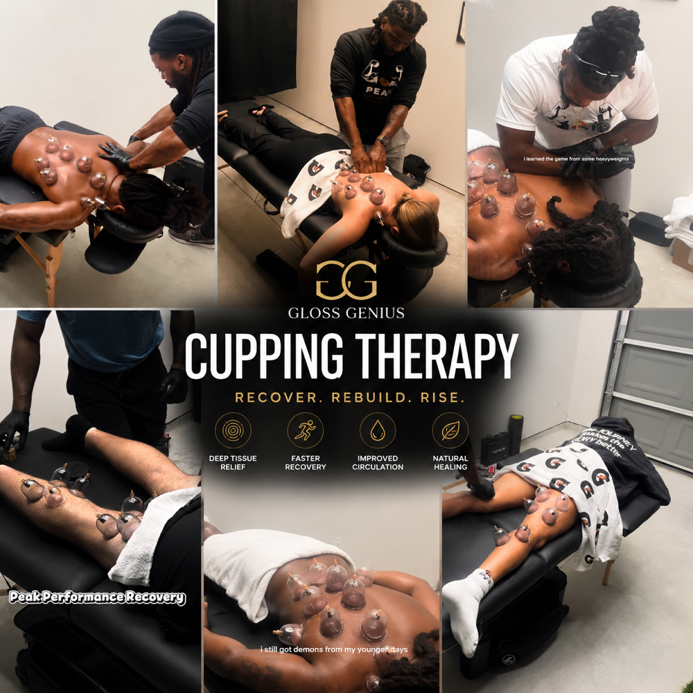Cupping Therapy at Peak Performance Recovery in Hockley, TX