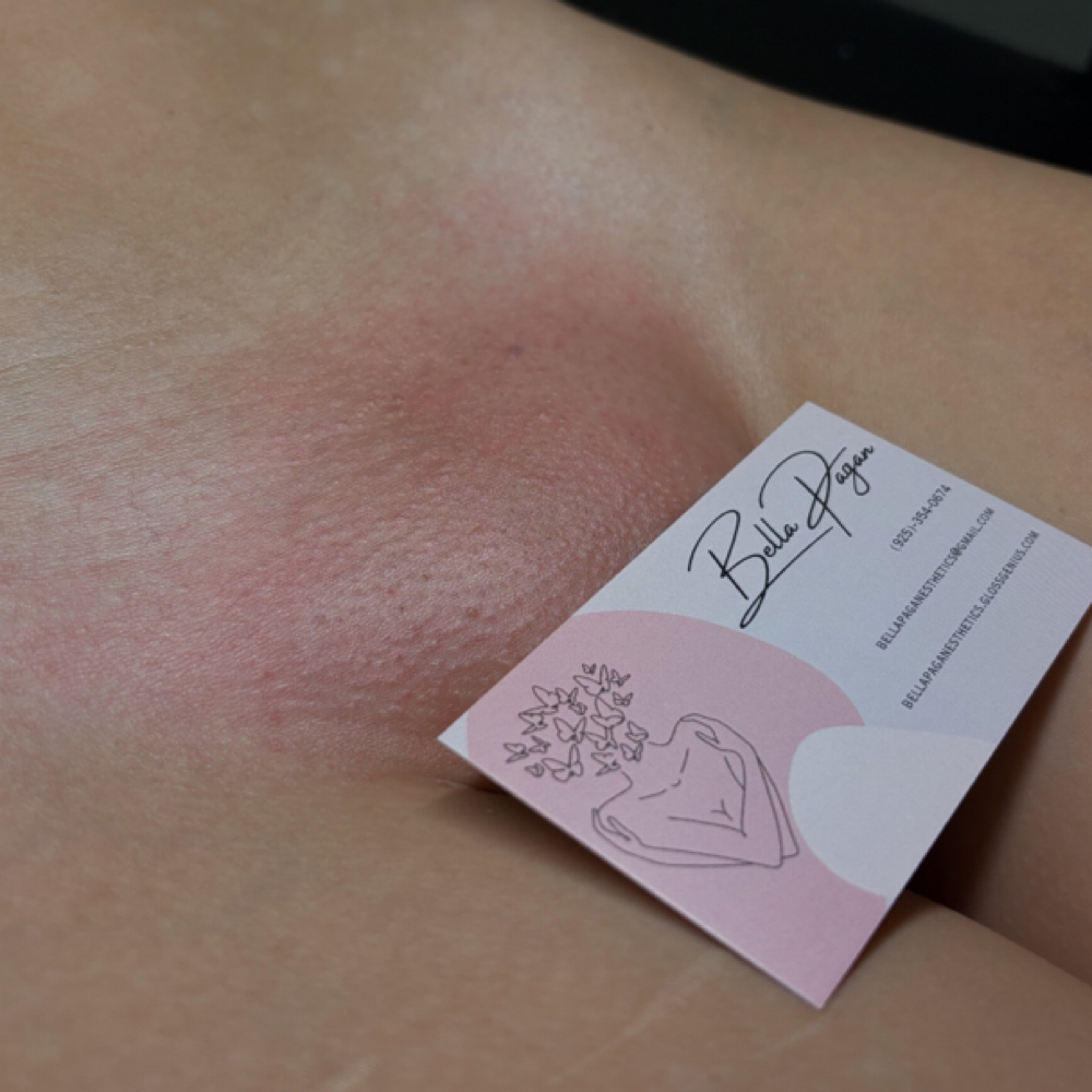 Brazilian at Bella Pagan Esthetics in Santa Rosa, CA