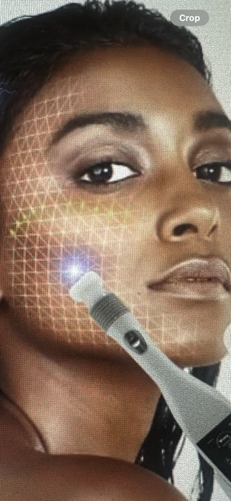 Jet Plasma Skin Tightening
