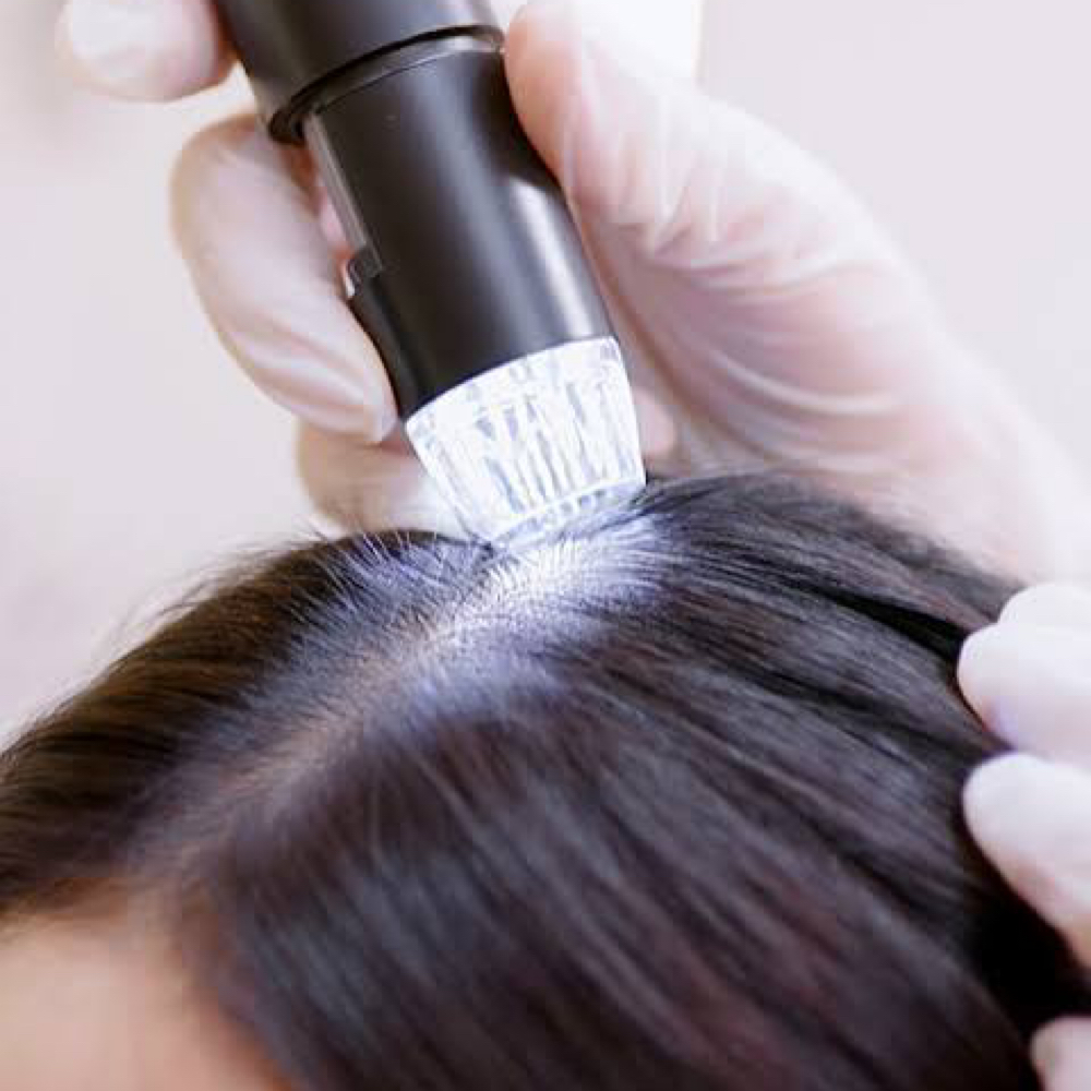 Scalp Treatment at Abbygale Tucker in Lakeport, CA